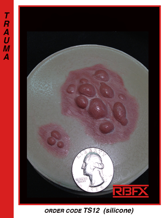 TS12 - silicone blisters/ bumps/ mutation