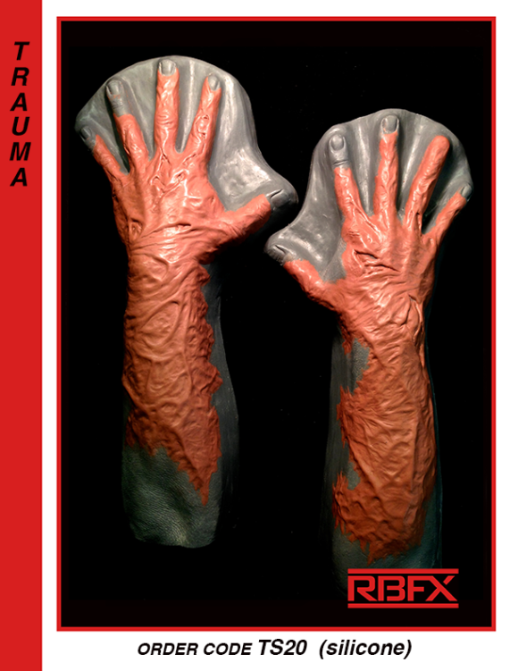 TS20 - burn/ trauma hands & arms