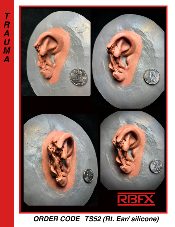 TS52 - Rt. Ear/ Trauma/ Silicone