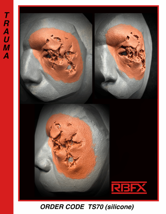 TS70 - Silicone left eye trauma