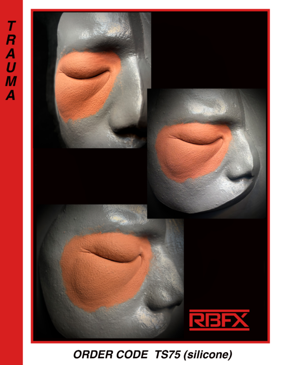 TS75 - Silicone Swollen Right Eye