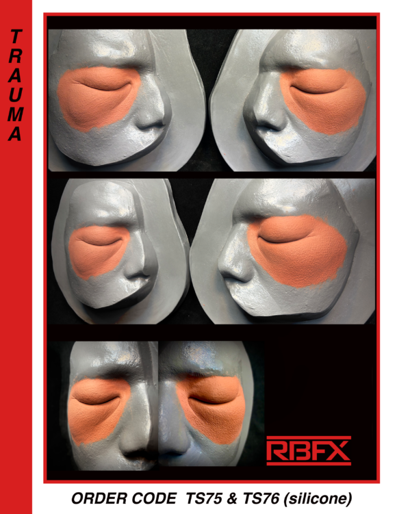 TS75 & TS76 - Silicone Swollen  Left & Right Eyes