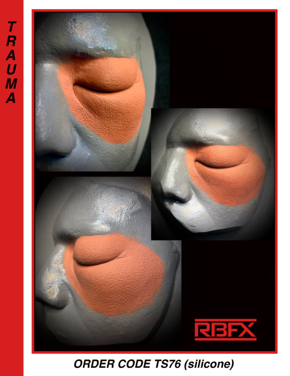 TS76 - Silicone Left Swollen Eye