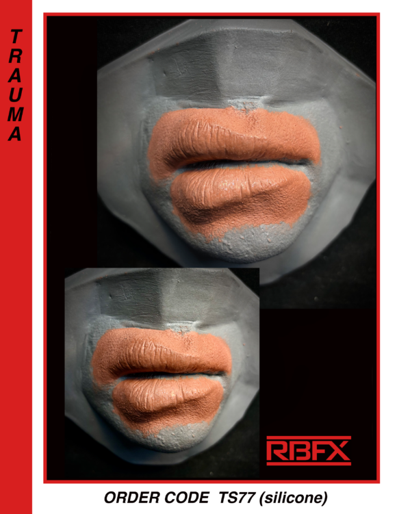TS77 - Silicone Swollen Lips