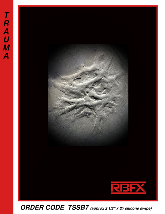 TSSB7 - Silicone Burn Scar
