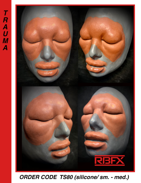 TS80 (w/ vacuform)- Silicone/ Allergic Reaction/Swollen