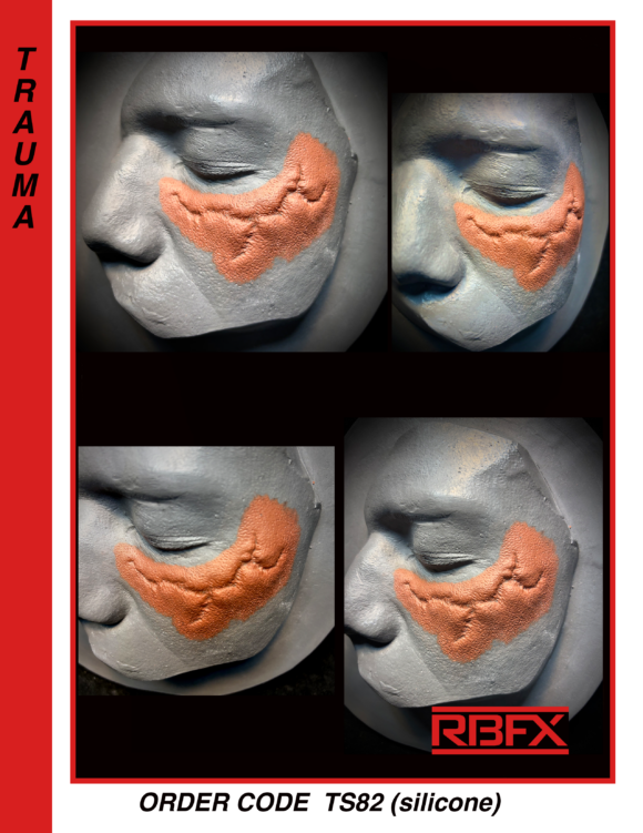 TS82 - Silicone left scarred cheekbone
